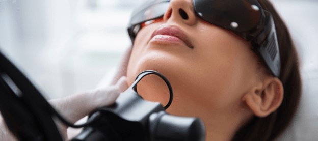 Carbon Peel Facial Laser Treatment Cost in Delhi 3