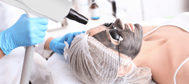 Carbon Peel Facial Laser Treatment Cost in Delhi 5