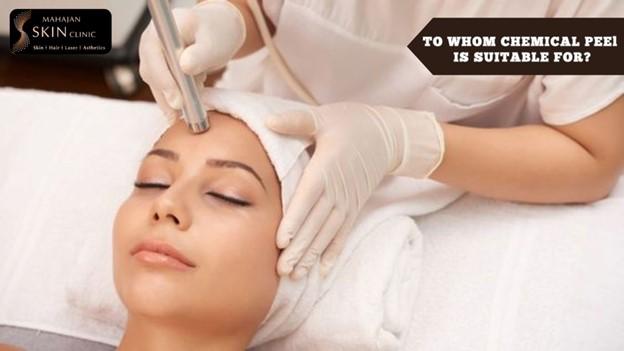 How to Choose the Right Chemical Peel Treatment