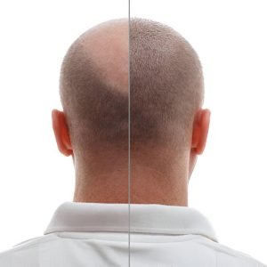 steptodown.com304435.jpg